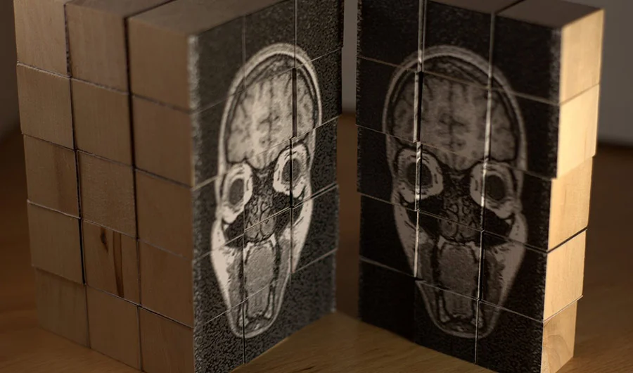 Brain Scans in the Courts: Prosecutor's Dream or Civil Rights Nightmare? (Inside Science)