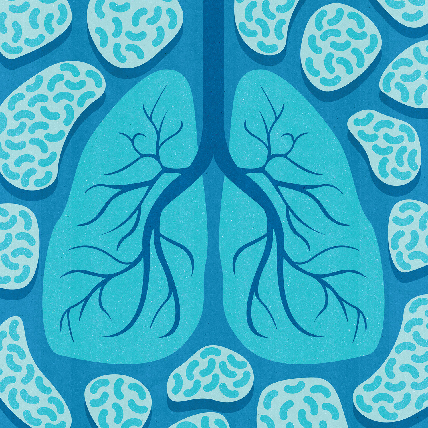 Lungs Virus Infection Blue 15 x 15 in_textures RGB 1500.jpg