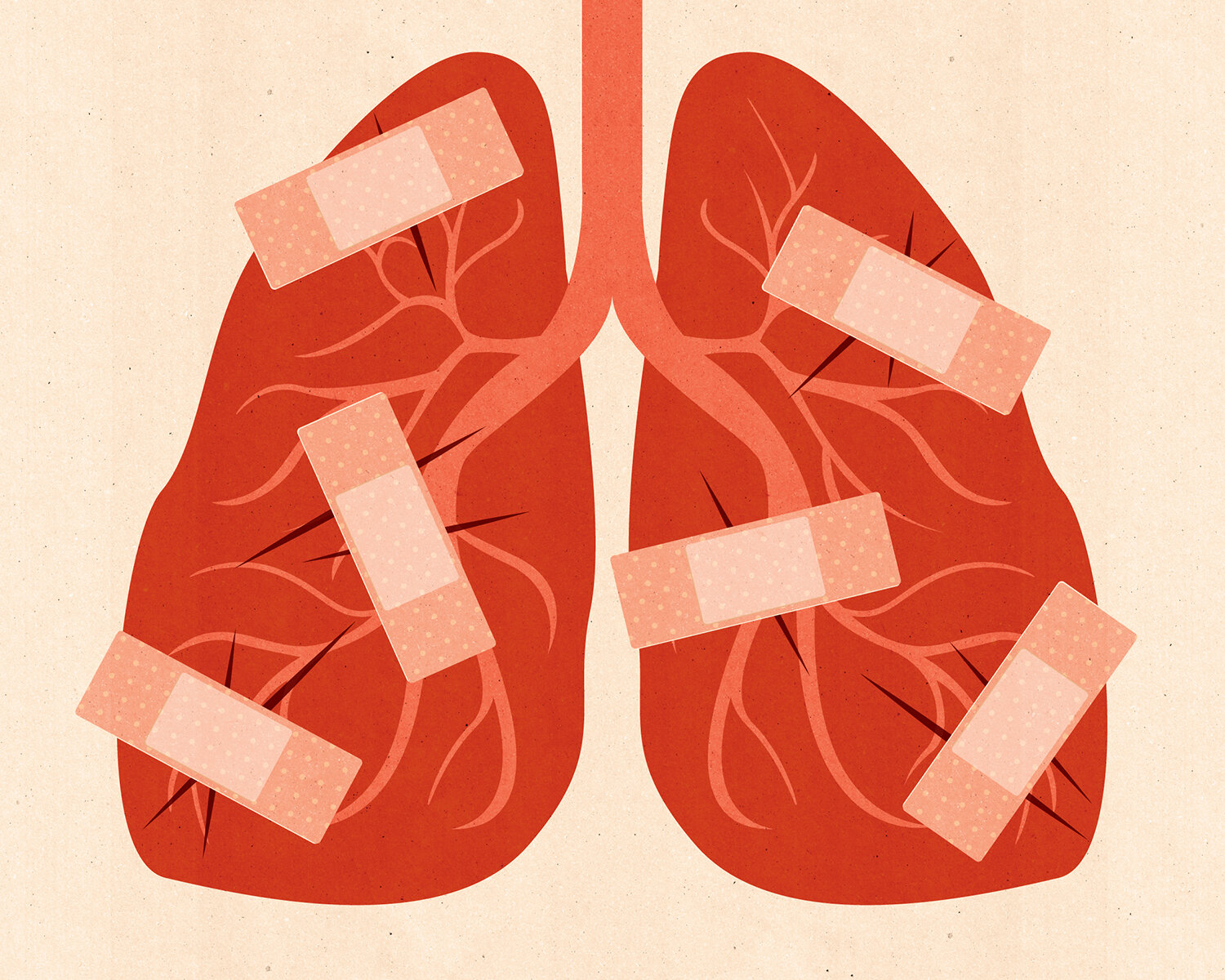 Healing Lungs 15 x 12 in_textures RGB 1500.jpg
