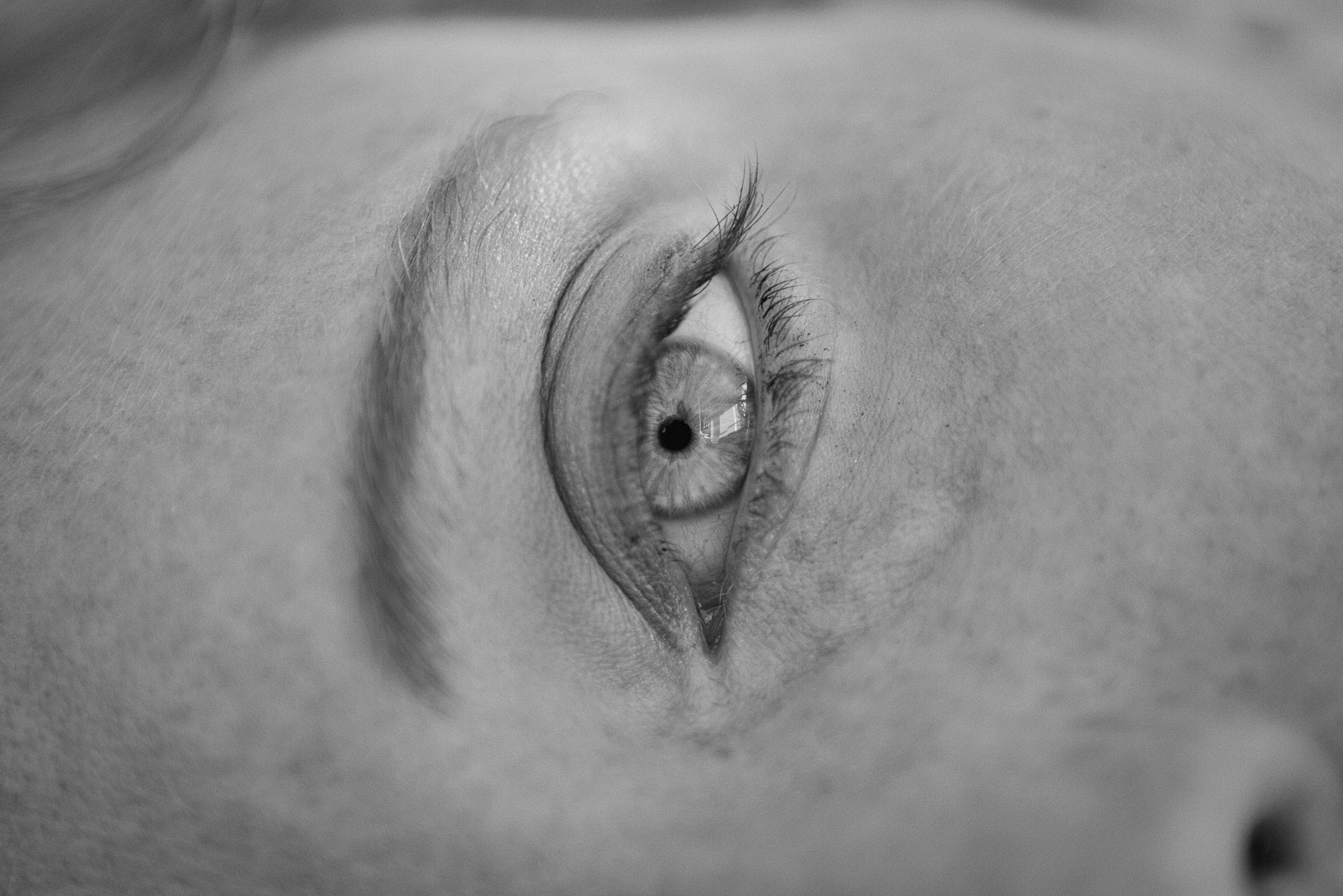 Eye
