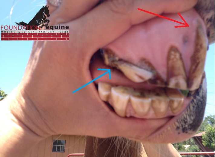 Another severely affected horse. The blue arrow points to a broken, "laid over" tooth and the red arrow points to a tooth with hypercementosis (note the bulging and amount of exposed tooth).