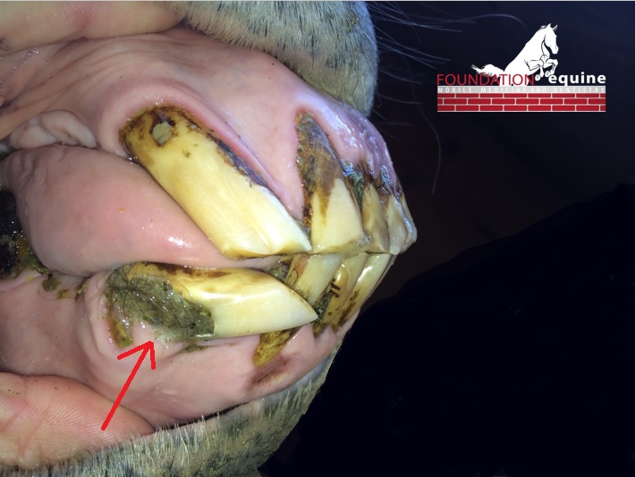 A good example of a resorptive lesion. The surface of the tooth is not intact, and the appearance is a little like a cavity. There is often feed material or hair stuck in the lesion.