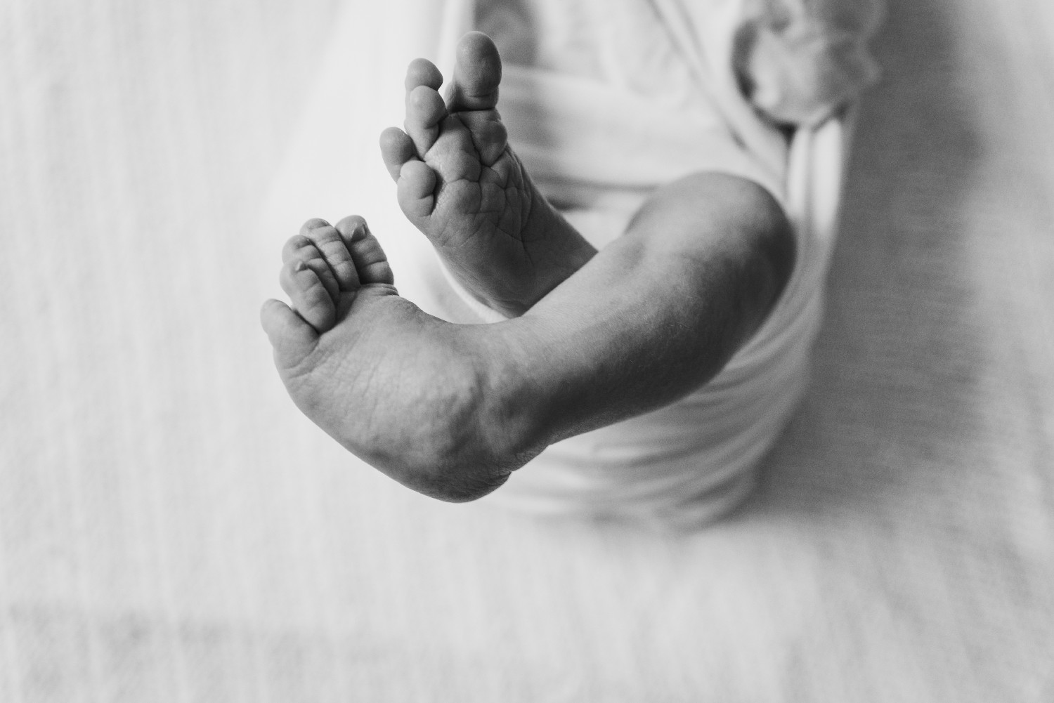 Newborn Clubbed Feet- Monmouth County Photographer
