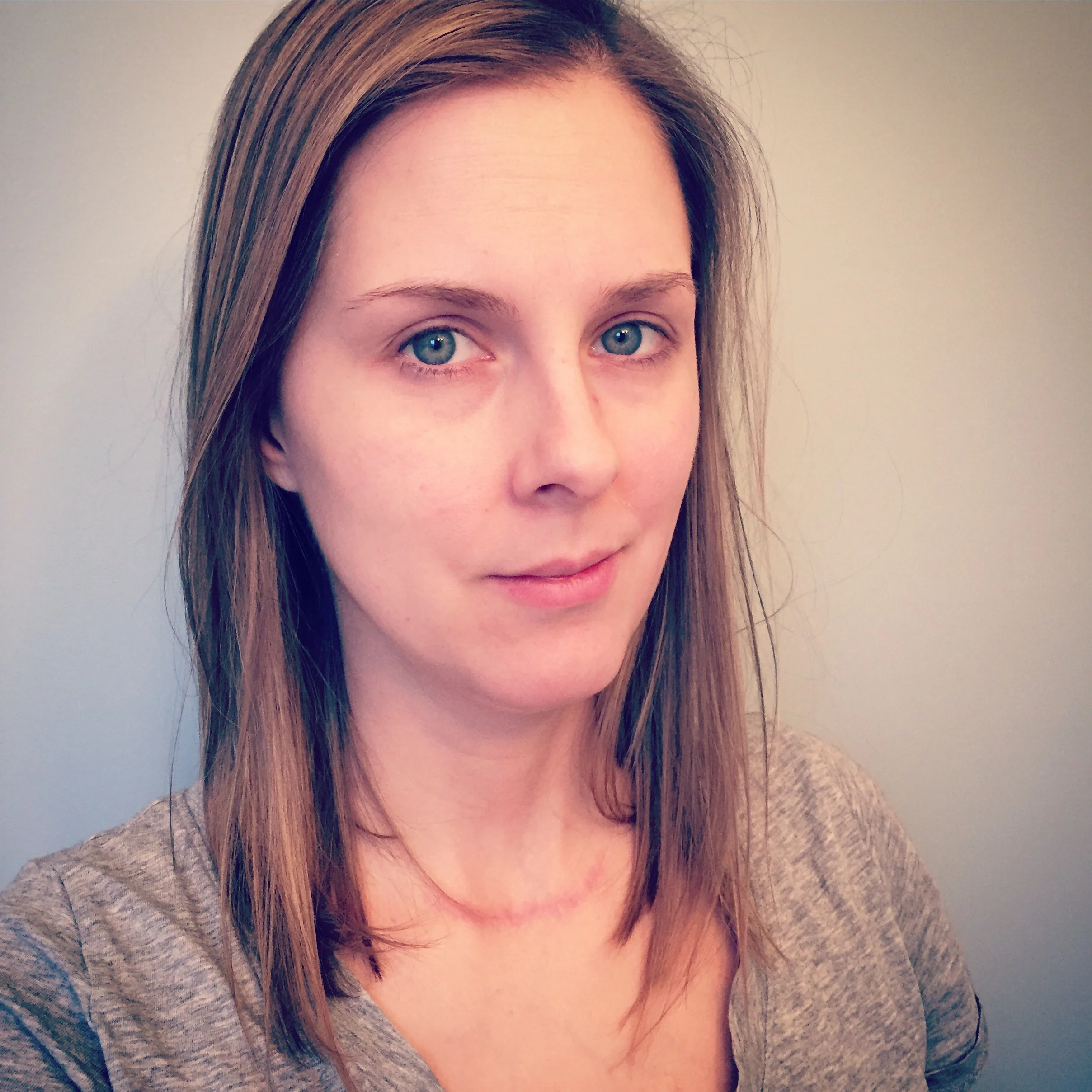 This is not the face of someone who excels at pregnancy. This is a still-throwing-up-at-30-weeks face. A my-hips-hurt-so-much-I-can't-climb-stairs-today face. A waiting-for-my-reproductive-psych-referral-to-be-processed face. A stop-commenting-on-the-shape-and-or-size-of-my-body-before-I-punch-you face. I'm struggling. And part of me wants to tell myself to shut up and stop whining because there are so many people out there who would give anything to be pregnant even if it meant being miserable. Part of me is ashamed for complaining when in the grand scheme of things I am incredibly lucky and privileged. But there's this tiny little part of me that's drowning out the Misery Blackjack today. This tiny little part is refusing to be quiet. It's saying "today is hard. Today I'm struggling. If you've got good thoughts to spare, I'll take them. And if you're struggling and need good thoughts, I'll send them. Let's not suffer in silence." Group hug, babies. Today is hard. Be nice to each other. ❤️