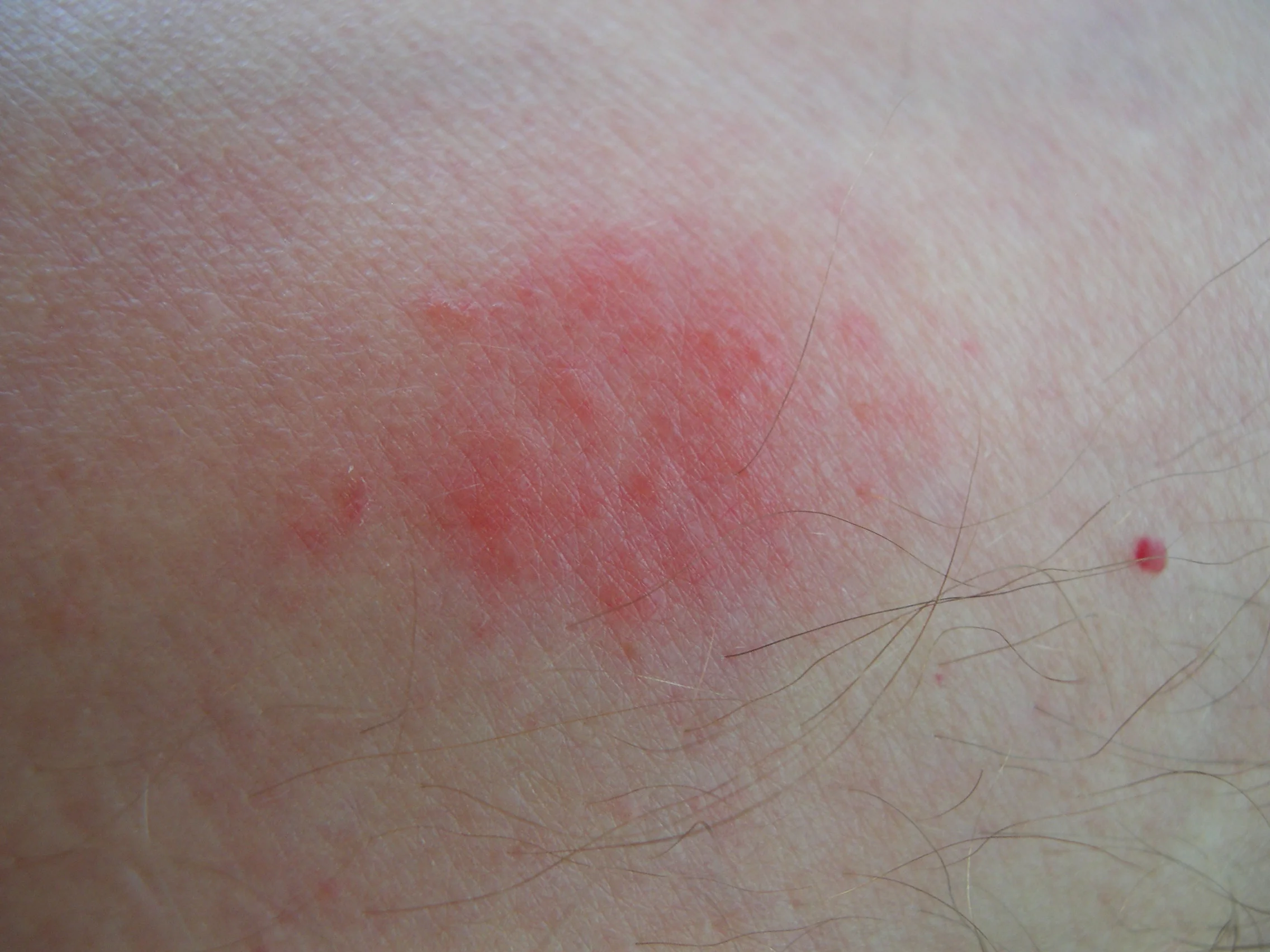 Bed bug picture bed bug bites bed bug photo bugs that look like