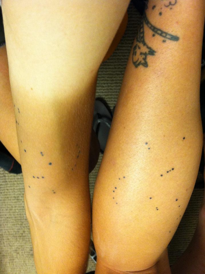 Cole's arm, my leg 
