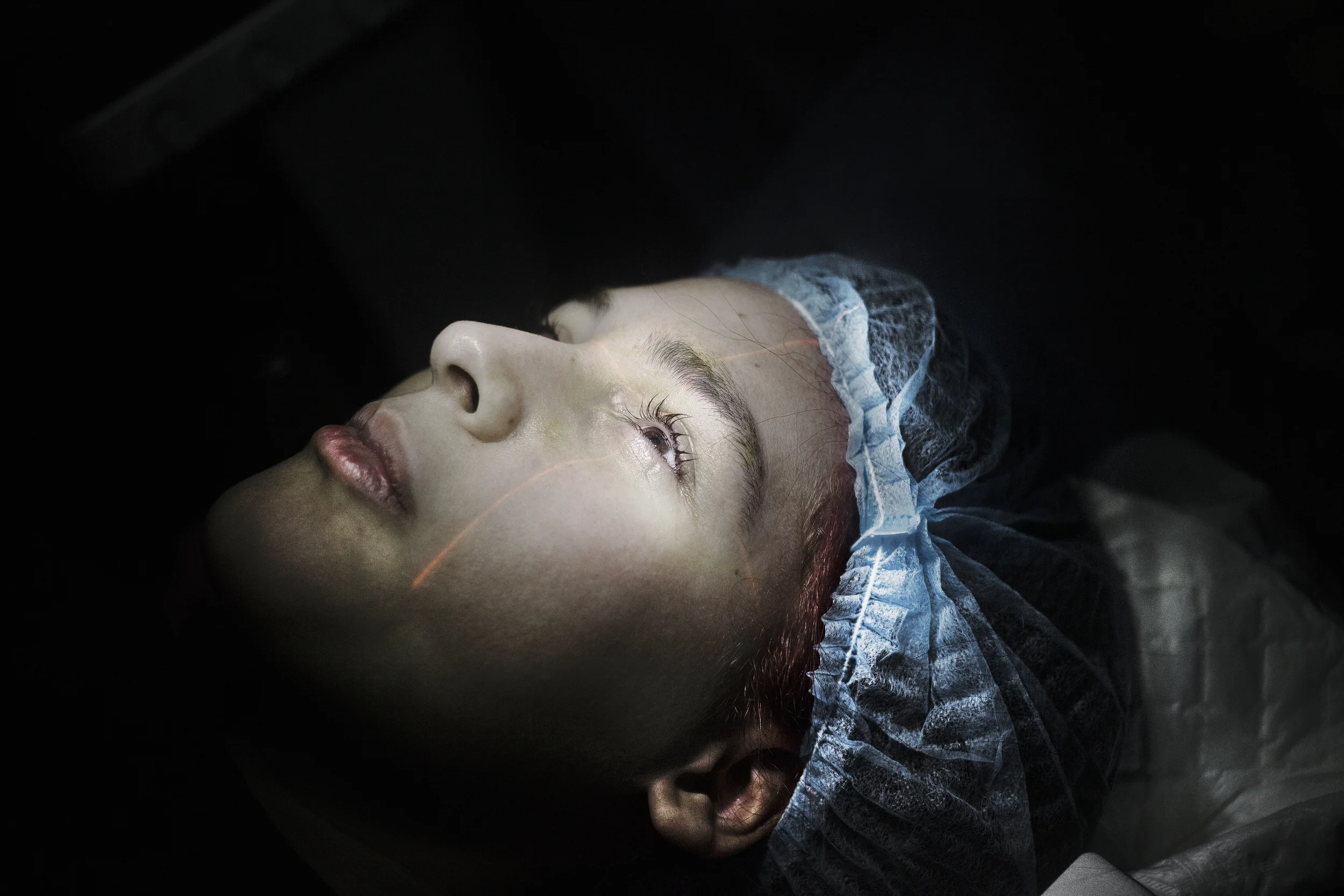 LASIK & Laser Eye Surgery
