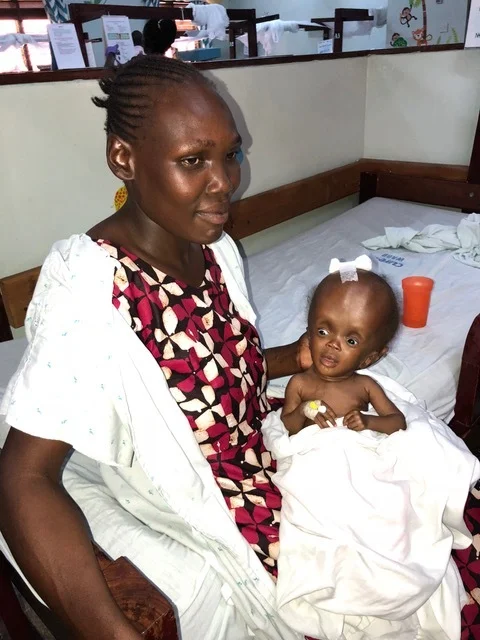 This one also has already had surgery, which will hopefully arrest the growth of her head.
