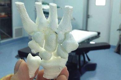 3D Printed Wrist Model (3DPrint.com)