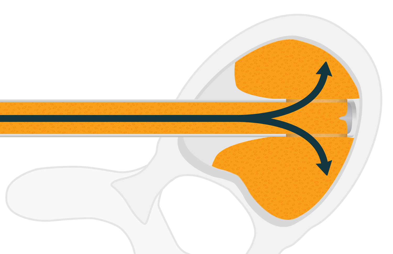 KG1_DualPorts_v04.png