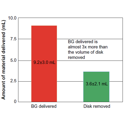 Figure 8: BG delivered versus disk material removed from the L4-S1 disk spaces. Abbreviations: BG, bone graft; DMR, disk material removed.