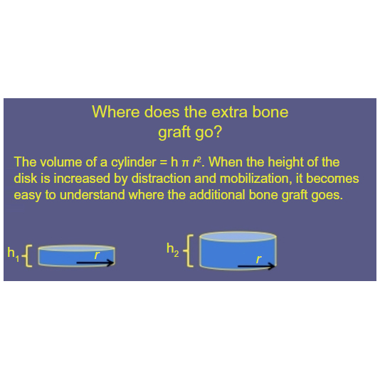 Figure 11: Geometric explanation for increased volume in a prepared, distracted disk space.