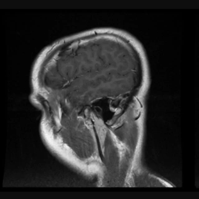 #Remember remember the sixth of November, the brain tumor trauma and plot. I see no reason why the brain tumor treason should ever be forgot. #8years