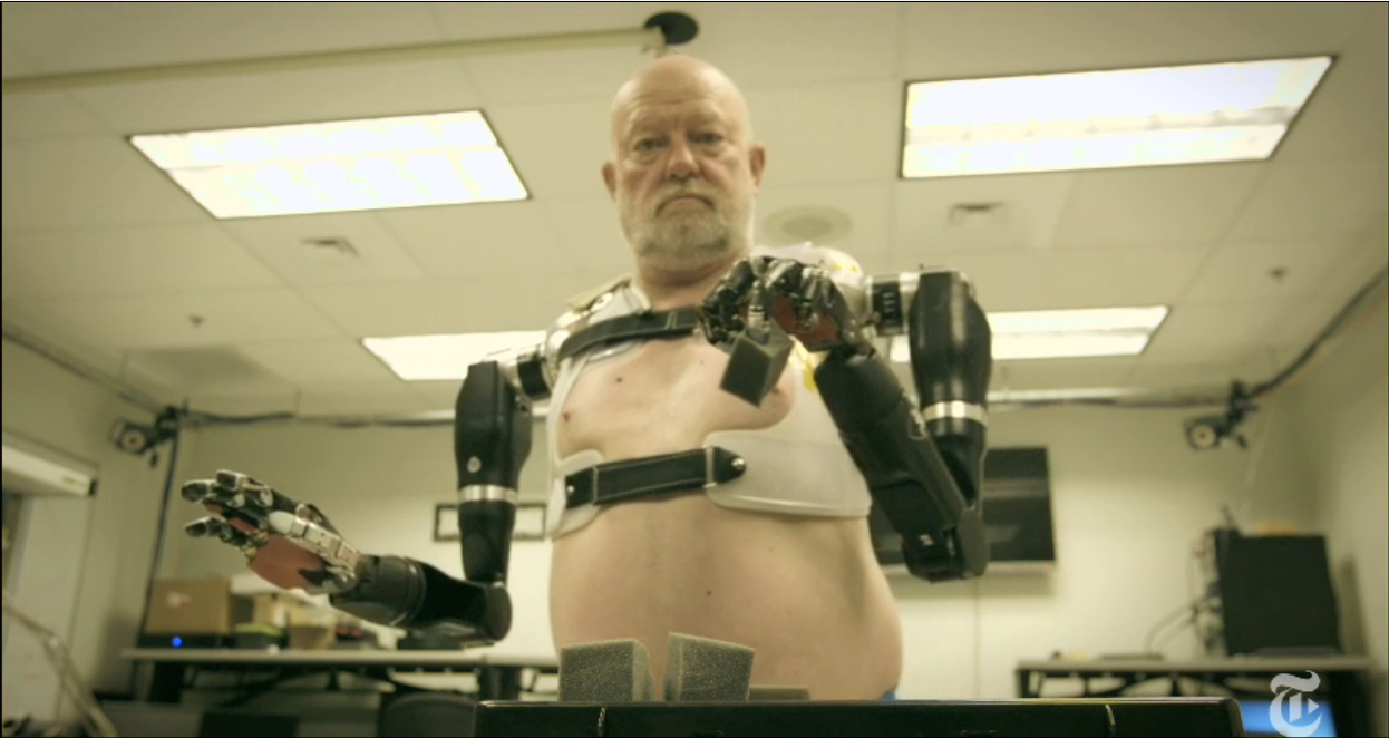 Nerve Controlled Prosthetics