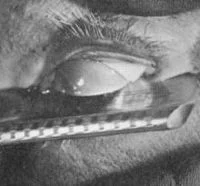 The shot of the eyeball (actually that of a dead calf) being slit by Buñuel
