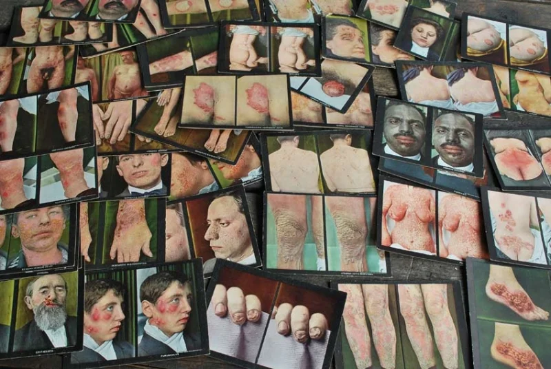 1910 STERIOSCOPIC SKIN DISORDERS (COMPLETE SET)