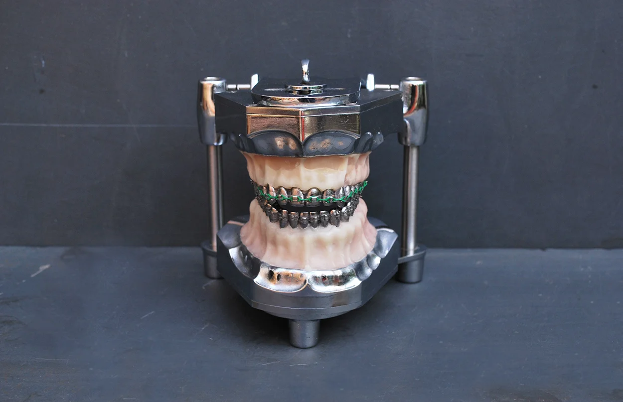 orthodontic_dental01.jpg