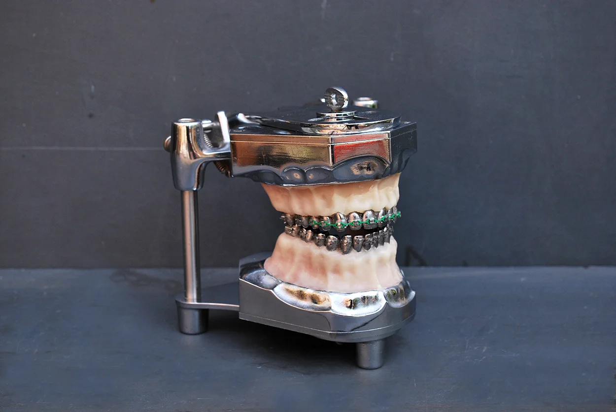 orthodontic_dental02.jpg