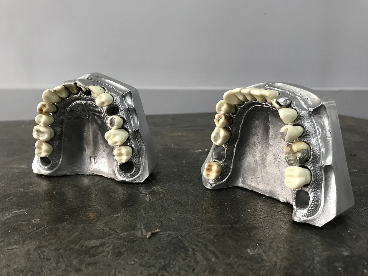Aluminum Dental Gums with Removable Teeth — AGENT GALLERY CHICAGO