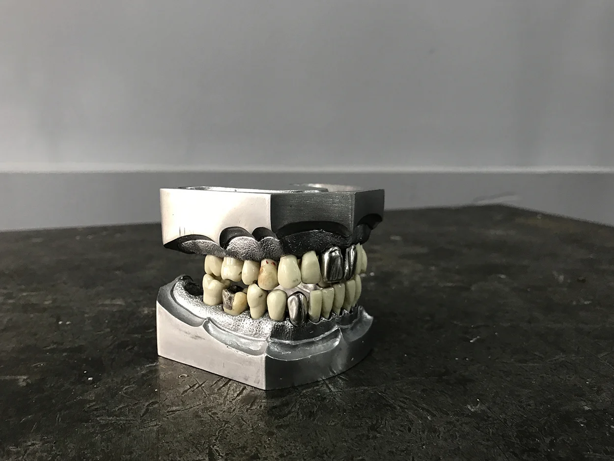 Aluminum Dental Gums with Removable Teeth — AGENT GALLERY CHICAGO