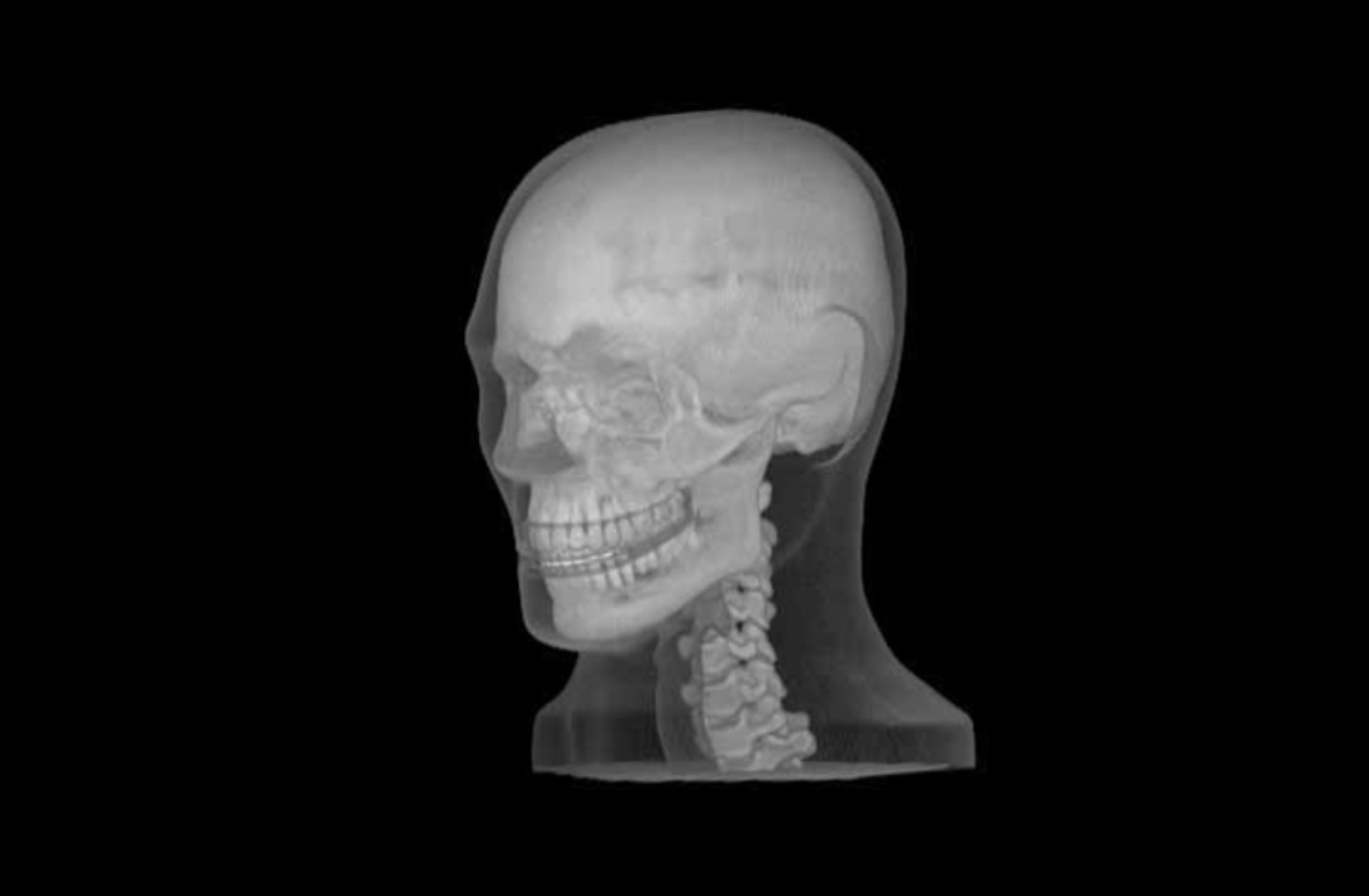 cirs xray phantom 08.jpg