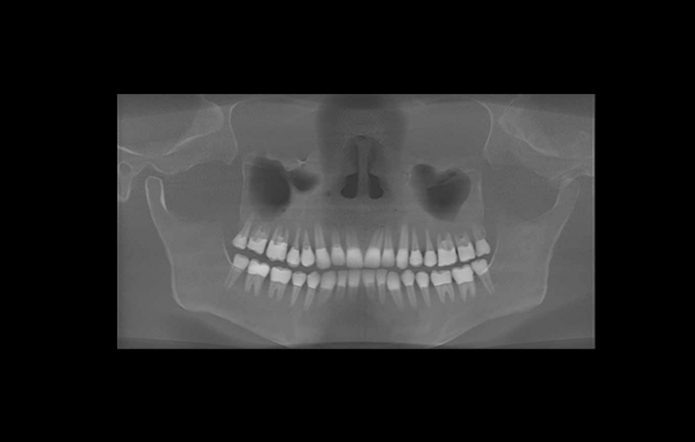 cirs xray phantom 09.jpg
