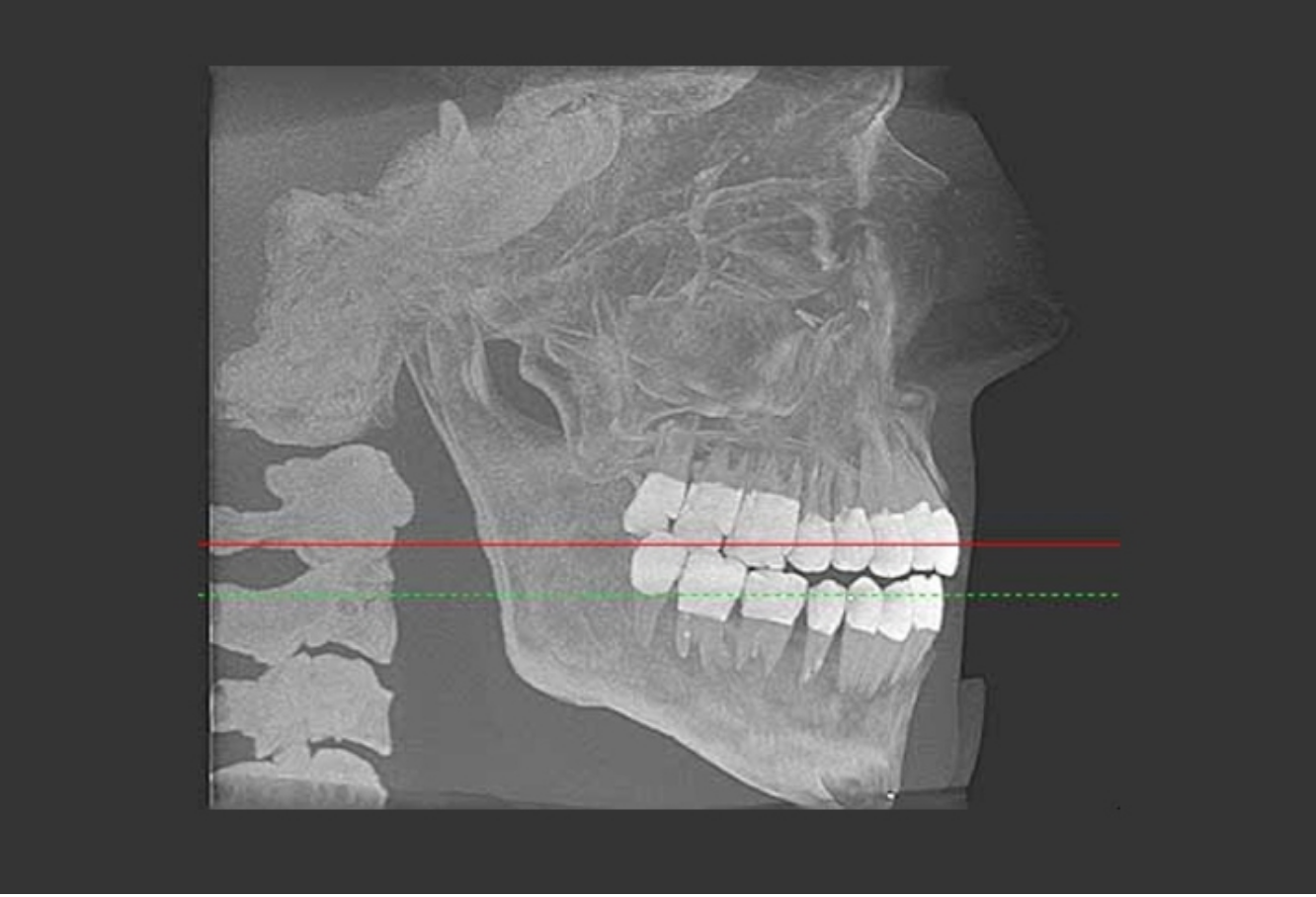 cirs xray phantom 10.jpg