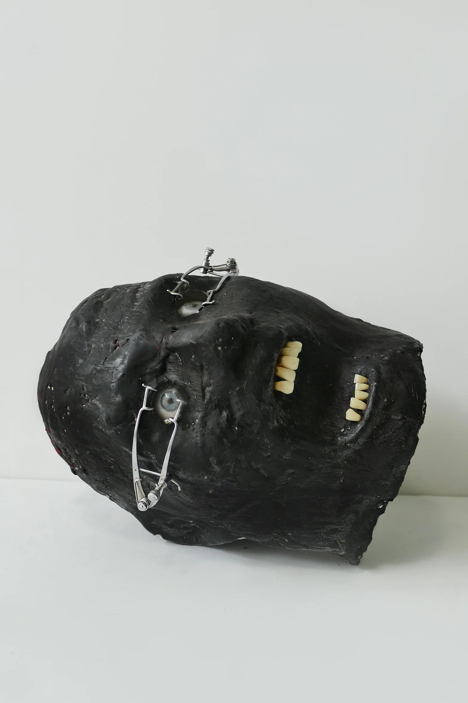 eye speculum 01.jpg