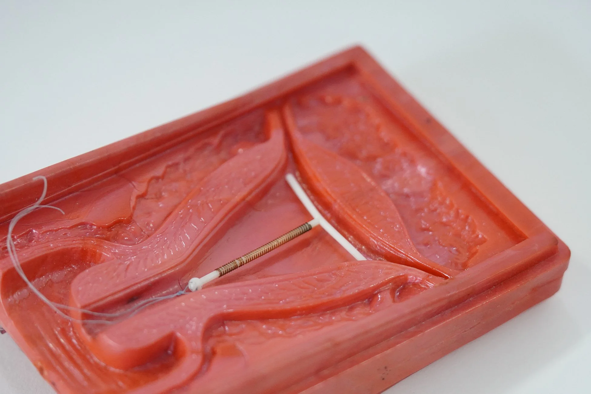IUD 06.jpg
