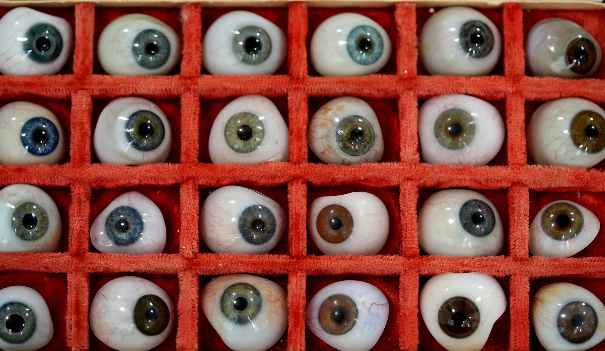 eyes case 02.jpg