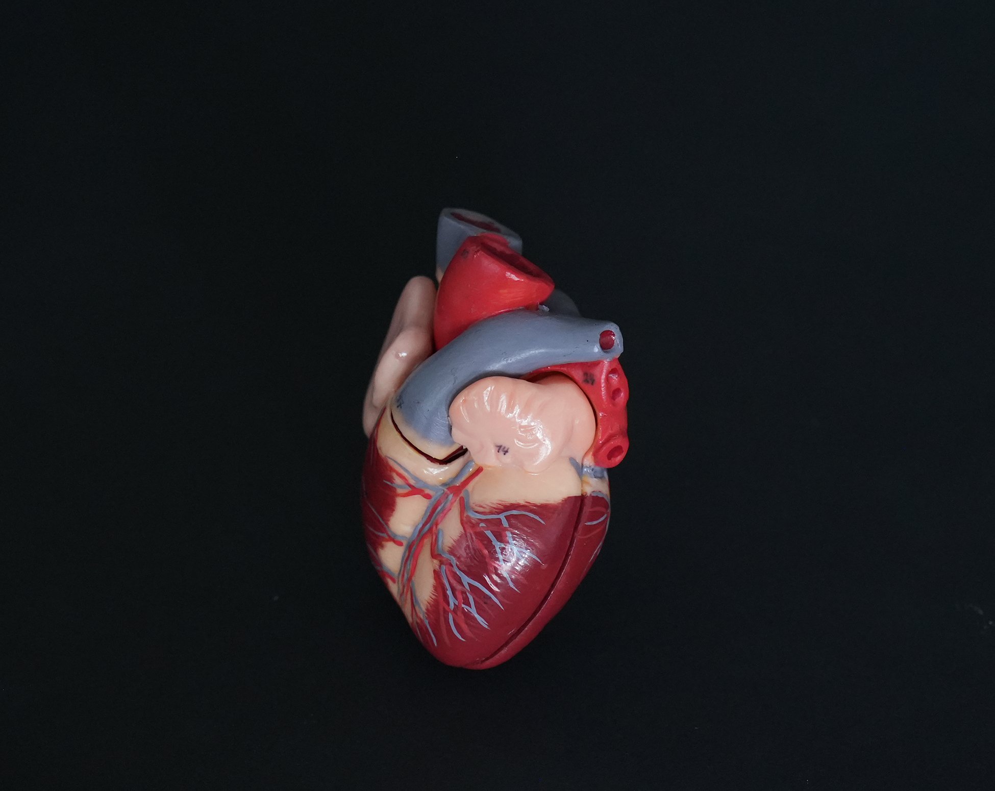 somso heart model 06.jpg