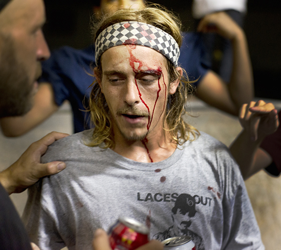 Bloody Skateboarder at the Streets Skatepark