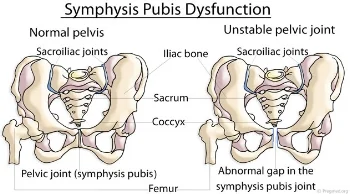 Image via: Pregmed.org