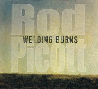 Welding Burns