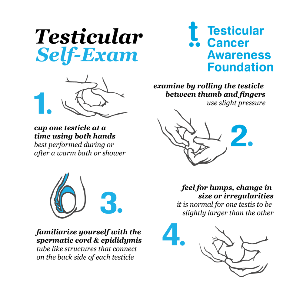 Exam self testicular cancer Testicular Cancer