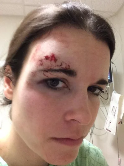 This is the picture I took in the hospital to see what I looked like.