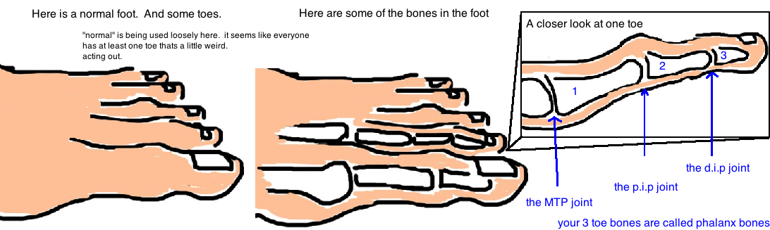 Lesser toe deformities