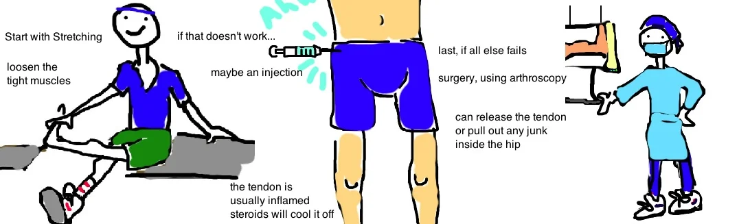 snap hip 4.jpg