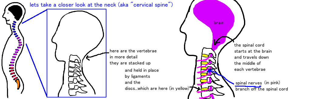 Pinched Nerve (Cervical Radiculopathy)