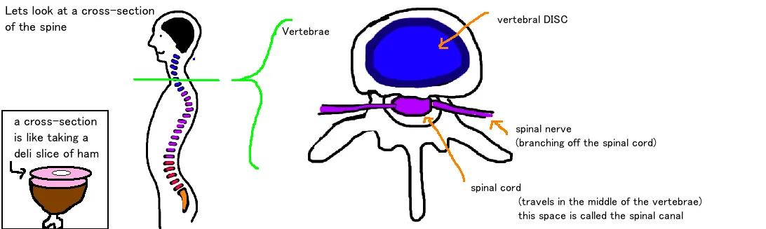 Neck Pinched Nerve Cervical Radiculopathy Bone Talks