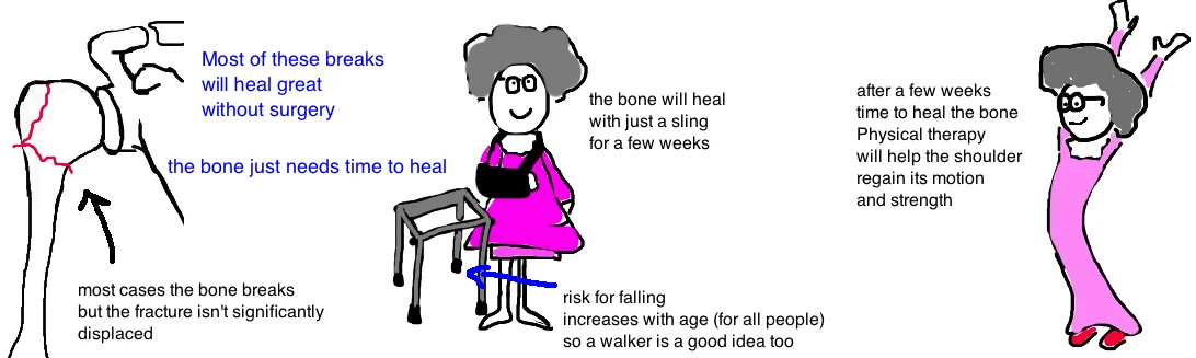 Broken Shoulder Proximal Humerus Fracture Bone Talks