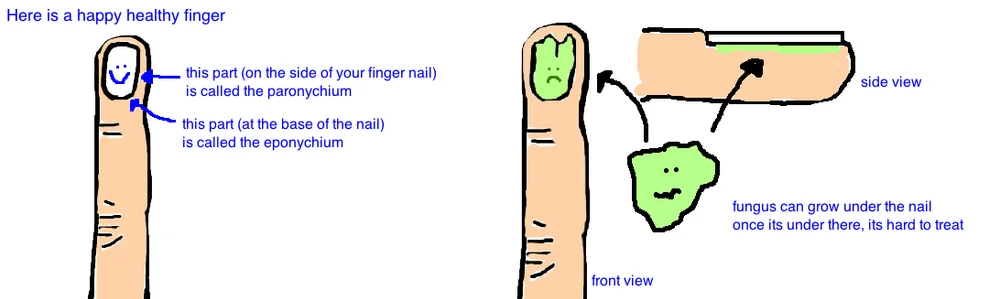 Nailbed And Finger Infections Bone Talks