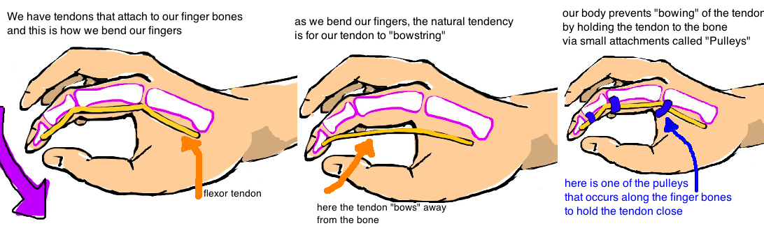 Trigger Finger Explanation In Spanish – QGRMH
