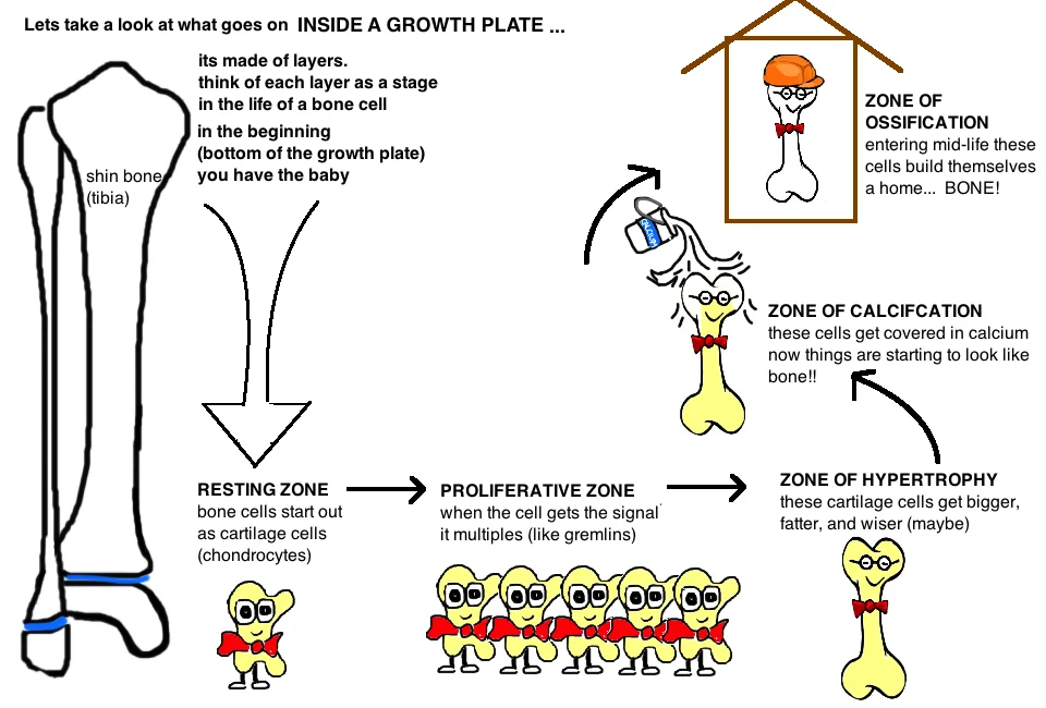 Kids Growth Plate Injury — Bone Talks