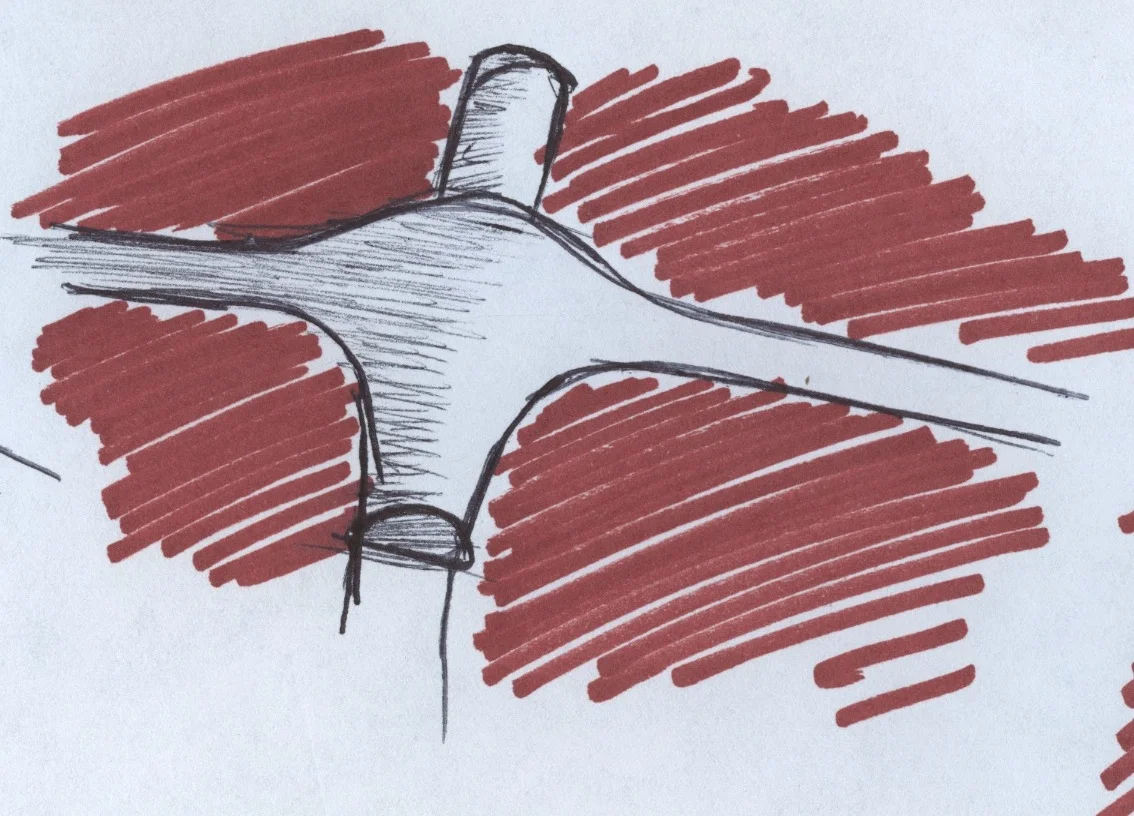 injection molding concept