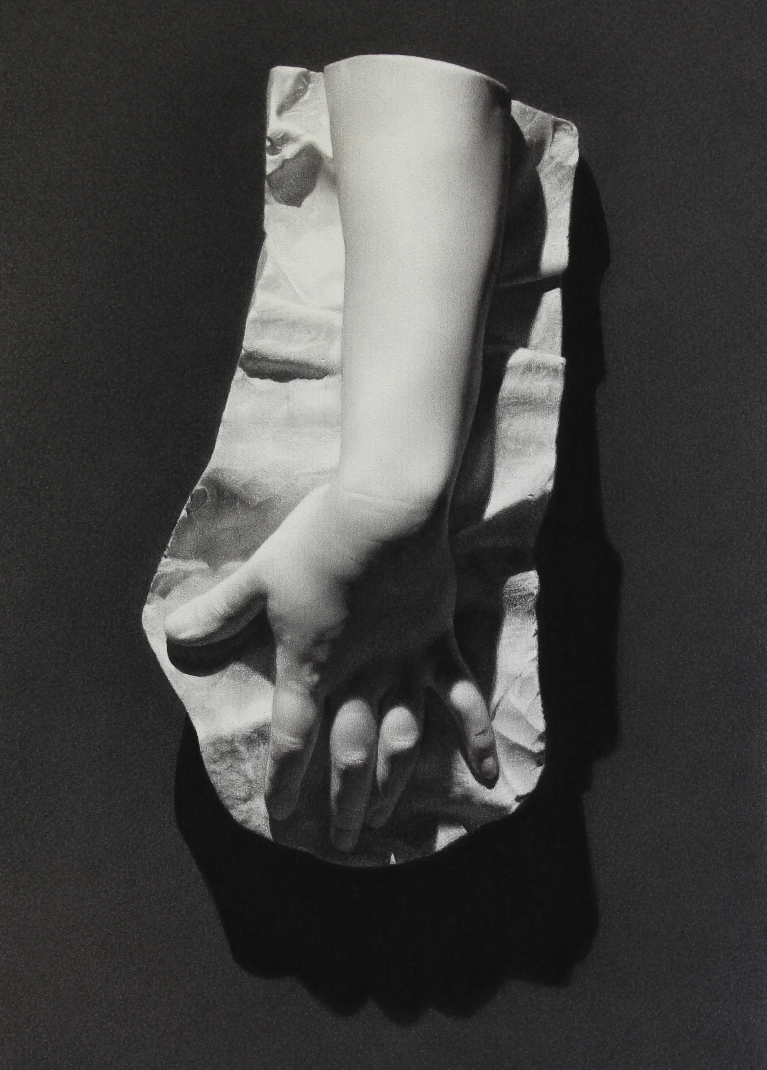 Marlies arm cast.jpg
