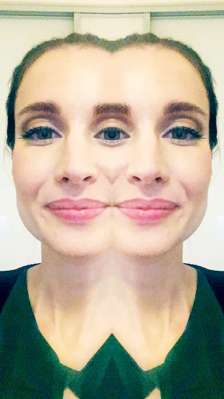 Hodnotenie zákroku na Klinike Yes Visage 