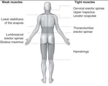  Layer Syndrome 
