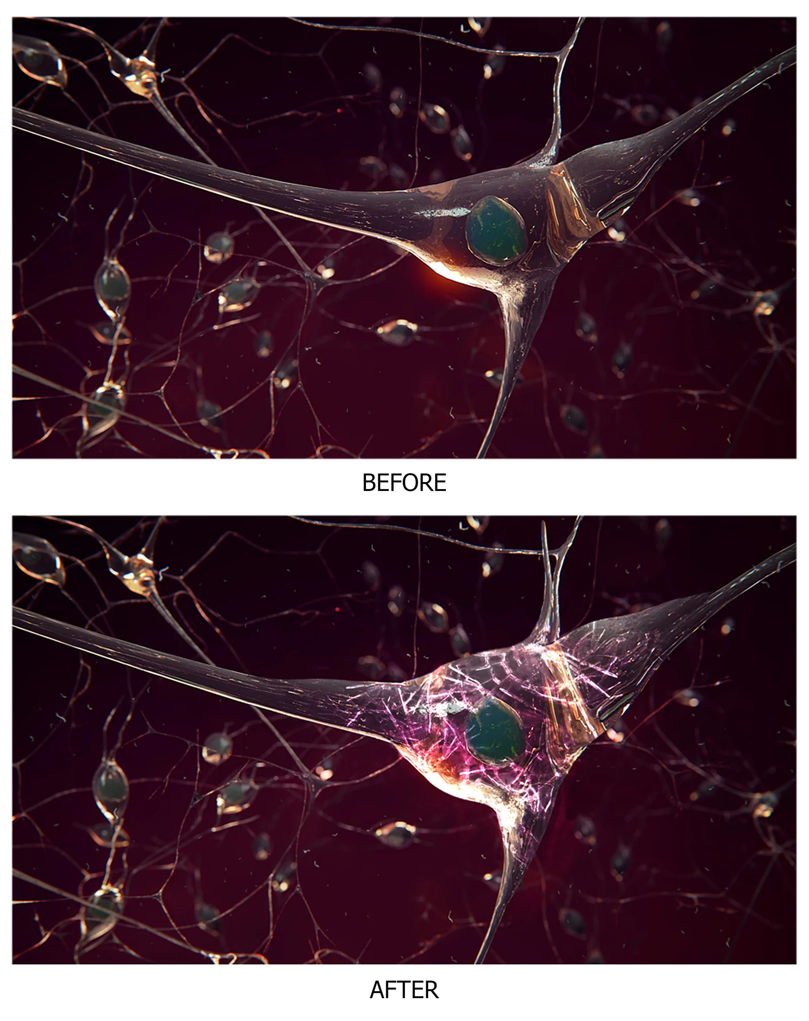 Acorda Therapeutics: Neuron Explosion