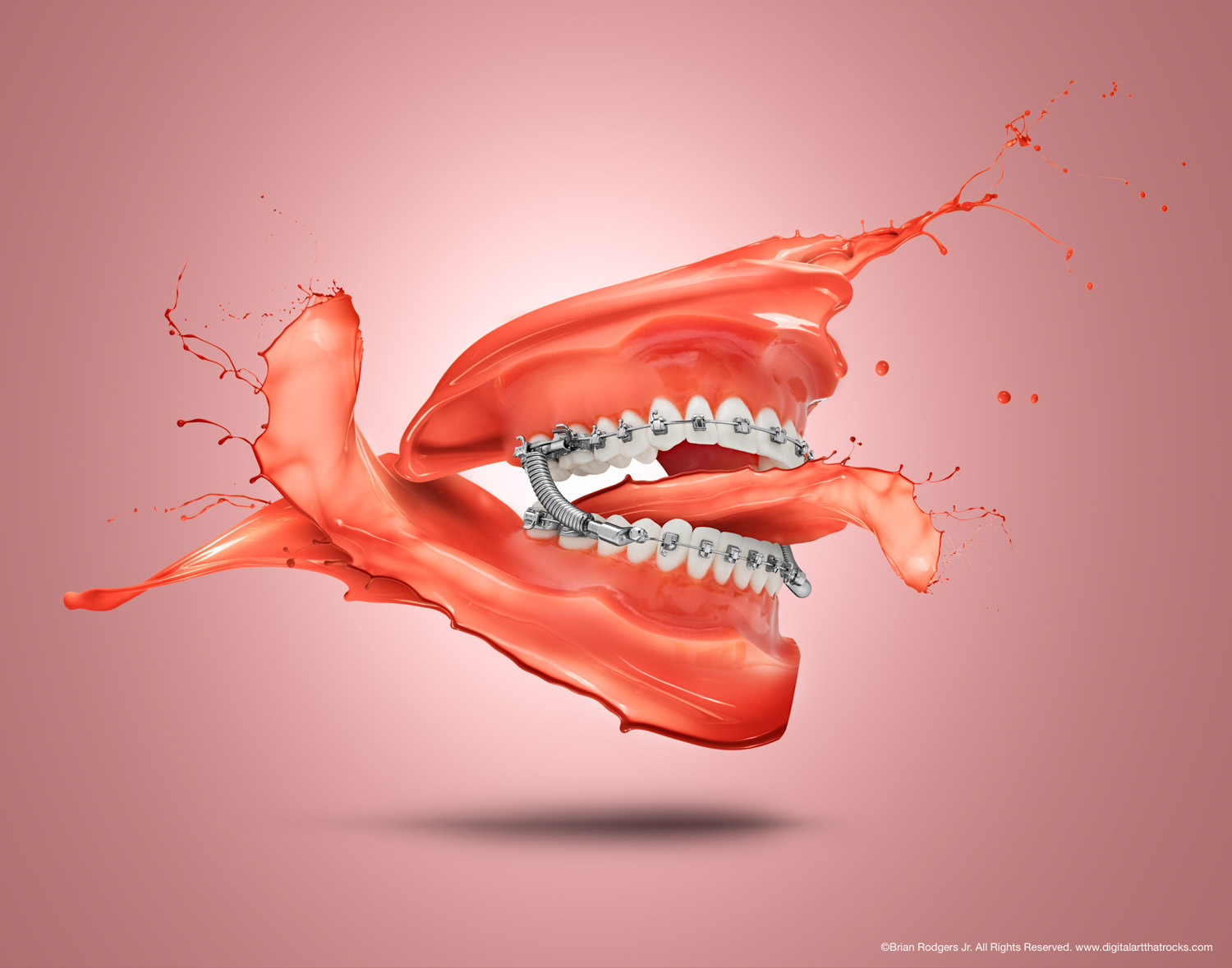 Orthodontic-liquid-splash-©-Brian-Rodgers-Jr-Digital-Art-That-Rocks-After.jpg